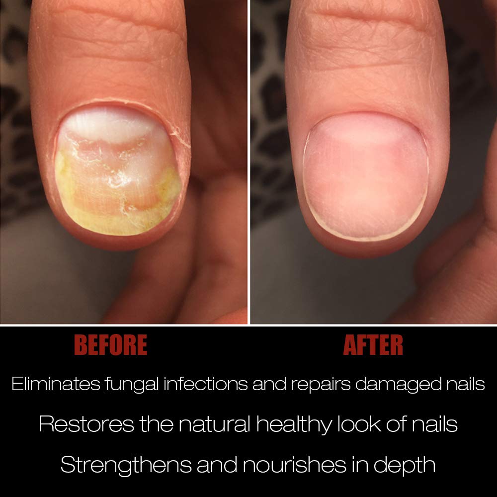 Simon & Tom Nails Pro Night Olio Unghie 10 ml rinforzante